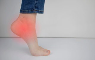 Walk Away from Plantar Fasciitis Pain—Naturally