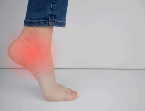 Naturally Ending Plantar Fasciitis Pain
