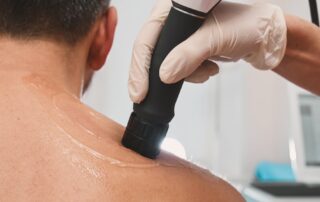 a patient receiving shockwave therapy on their shoulder at Whitefish Chiropractor in Montana from a licensed chiropractor.
