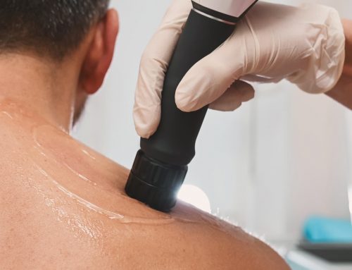 How Many Shockwave Therapy Sessions Are Required for Results?